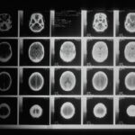 Photo Brain scan