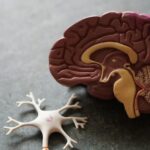 Photo Brain scan